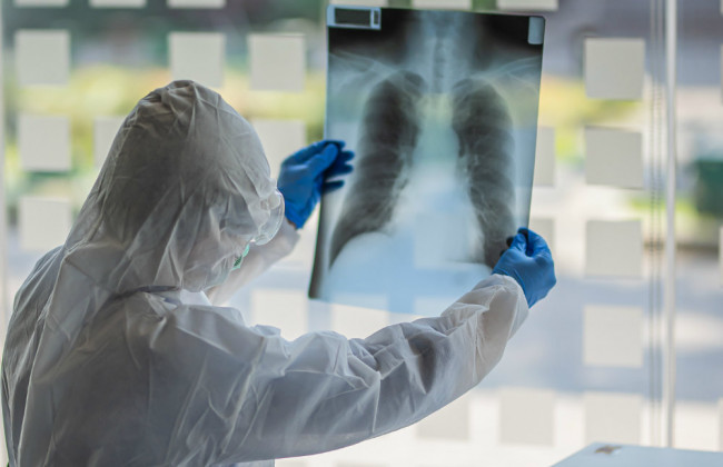 Какие внутренние органы поражает COVID-19