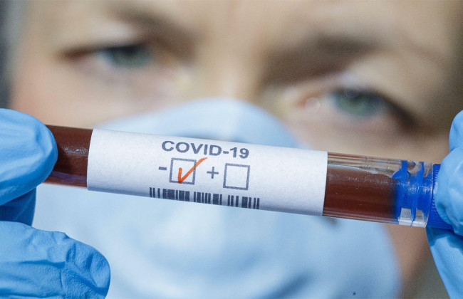 Найден способ предсказать тяжесть течения COVID-19