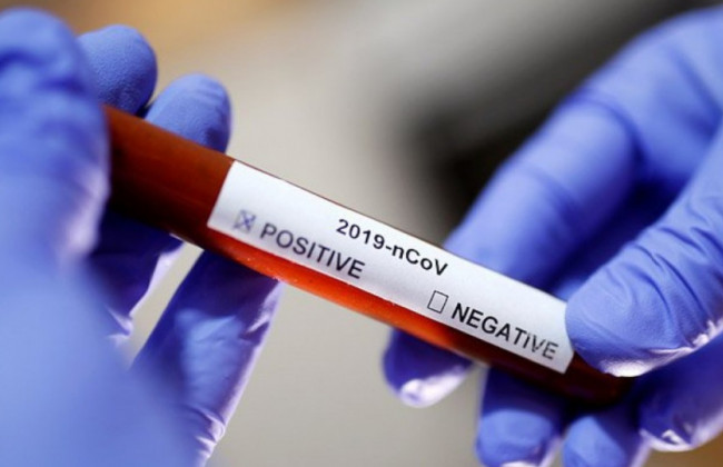 Коронавирус в Украине: за сутки более 17 тысяч новых зараженных