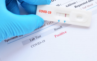 Новое исследование ставит под сомнение популярный тест на COVID-19