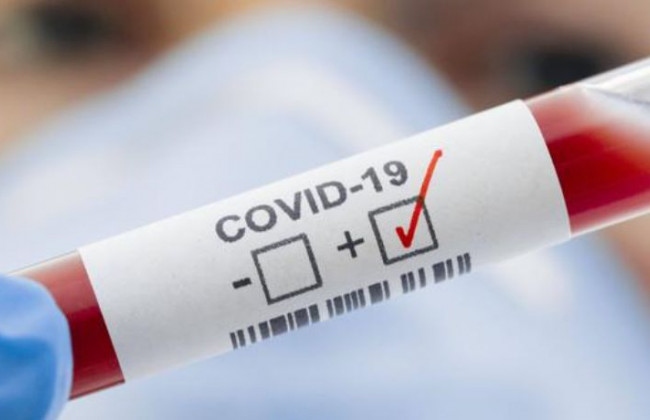 Рада планує запровадити електронне посвідчення ветерана