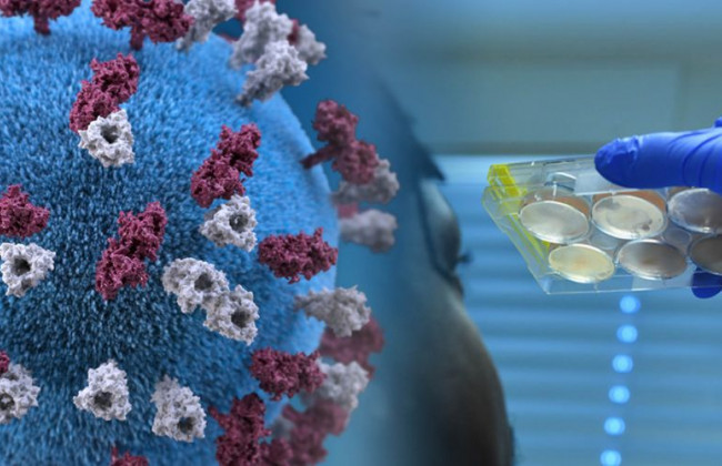 Простой анализ может указать на воспаление легких при коронавирусе