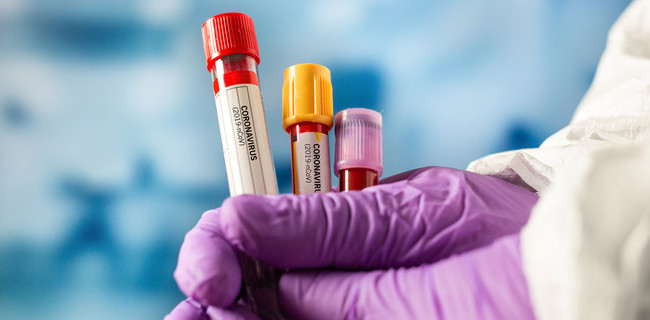 Оказался сильно устойчивым к вакцинам: назвали особенность штамма «Мю»