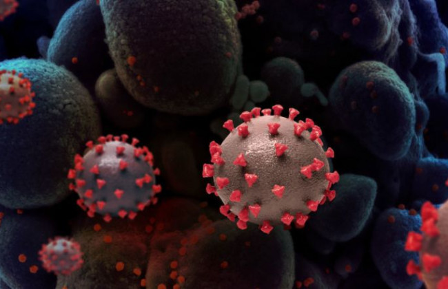 Объяснили сильную заразность штамма «Дельта»