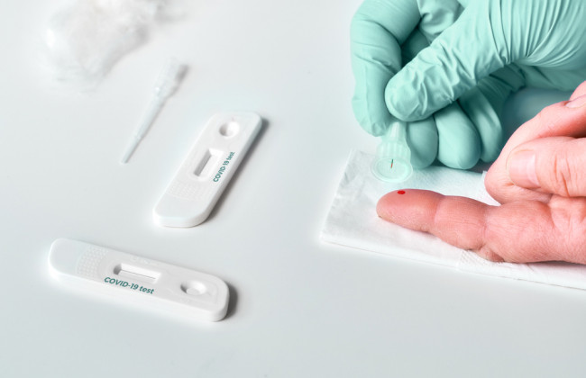 В Германии хотят вернуть бесплатные тесты на коронавирус