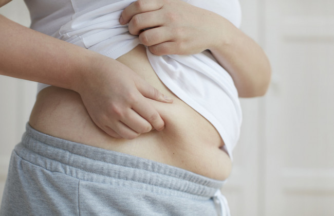 Коронавирус и ожирение: как влияет избыточный вес на течение заболевания