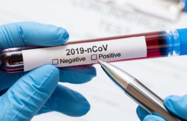 Медики выяснили, у кого больше шансов защититься от штамма «Дельта»