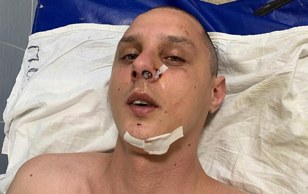 В Киеве жестоко избили музыкального продюсера хита группы KAZKA