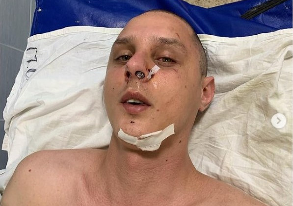 Музыканту группы KAZKA проломили череп у подъезда