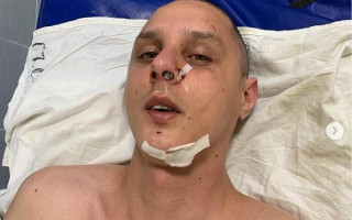 Музыканту группы KAZKA проломили череп у подъезда