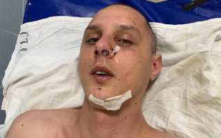 В Киеве жестоко избили музыкального продюсера хита группы KAZKA