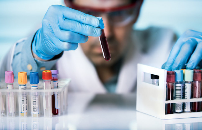 Симптомы могут проявиться не сразу: для кого опасны штаммы «Дельта» и  «Дельта плюс»