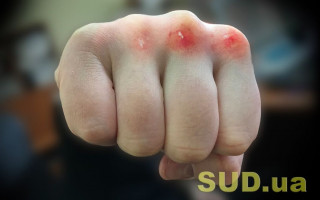 В Киеве мужчина жестоко избил известного продюсера: есть подробности