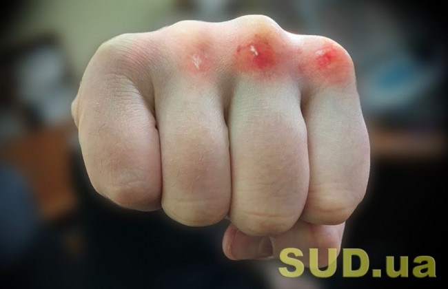 В Киеве мужчина жестоко избил известного продюсера: есть подробности