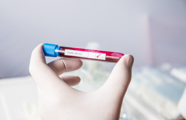 COVID-статистика: в Украине более 24 тысяч новых случаев и 750 смертей