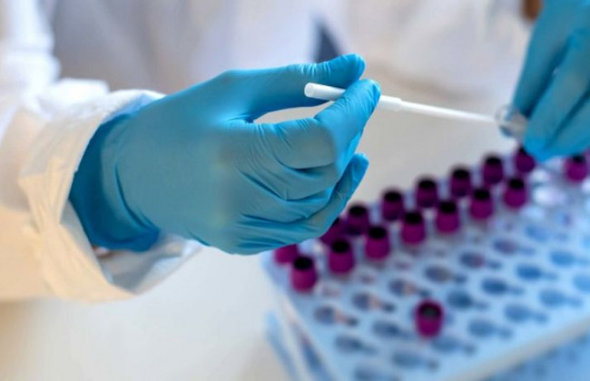 В Украине обнаружили 11 различных вариантов штамма «Дельта»