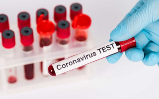 Число новых COVID-случаев в Украине упало до 18,2 тысяч