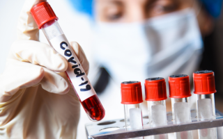 Спад новых случаев: в Украине за сутки менее 8 тысяч больных коронавирусом