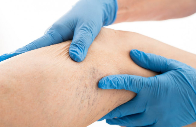 Назвали самое опасное осложнение коронавируса