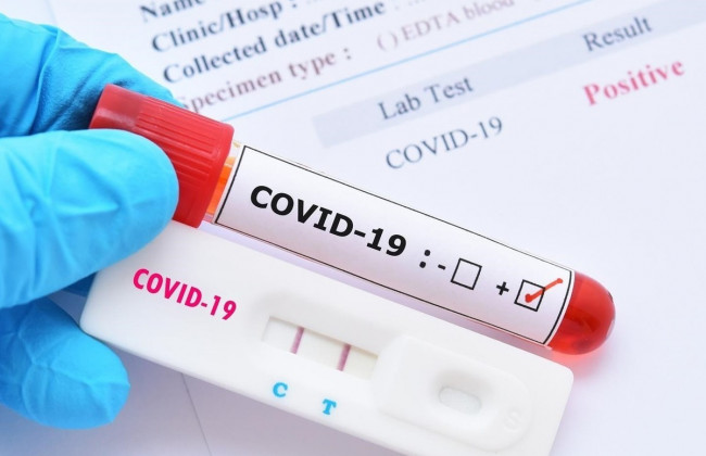 В Украине почти 16 тысяч новых случаев COVID-19