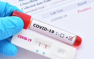 В Украине почти 16 тысяч новых случаев COVID-19