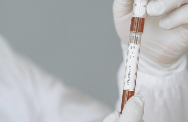 В Финляндии заподозрили первые случаи заражения штаммом «Омикрон»