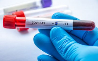 В Украине 5804 новых случая COVID-19