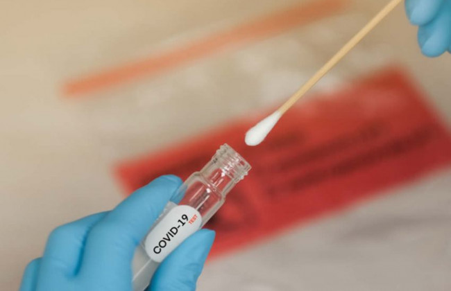 Может оказаться, что некоторые тест-системы в Украине не определят омикрон-штамм, – врач