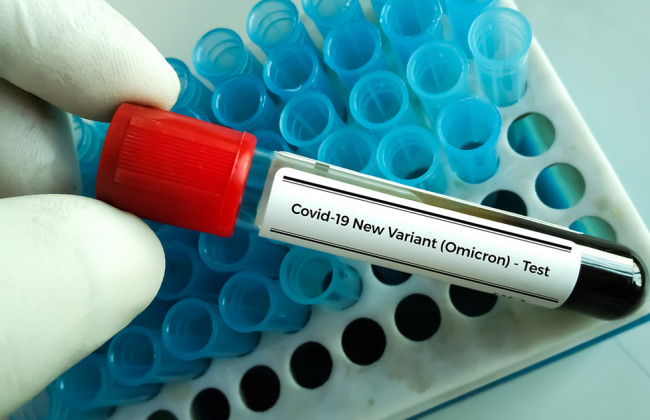 Как протекает заражение омикрон-штаммом коронавируса