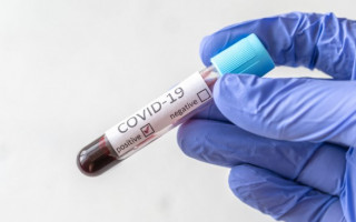 В Украине более 11 тысяч COVID-случаев