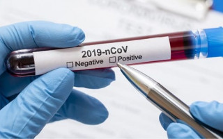 В Украине более 9 тысяч новых случаев коронавируса