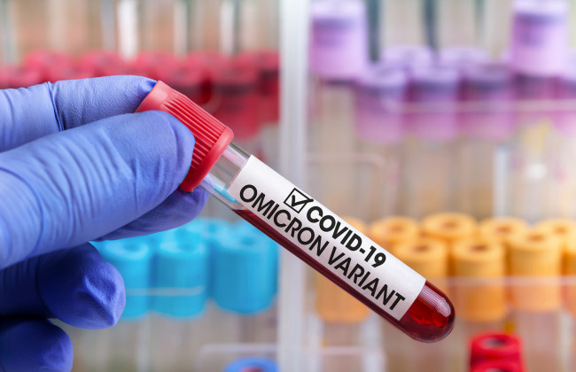 Первые симптомы ощущаются через 5-6 дней после заражения: как проявляется «Омикрон»