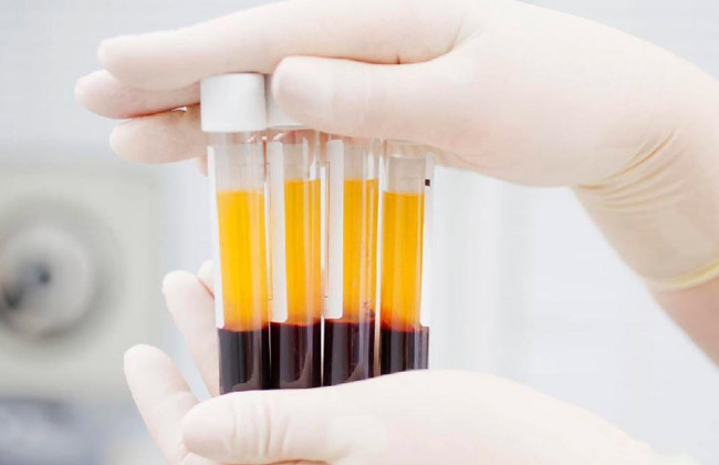 Змішування плазми крові: винайдений новий спосіб лікування коронавірусу