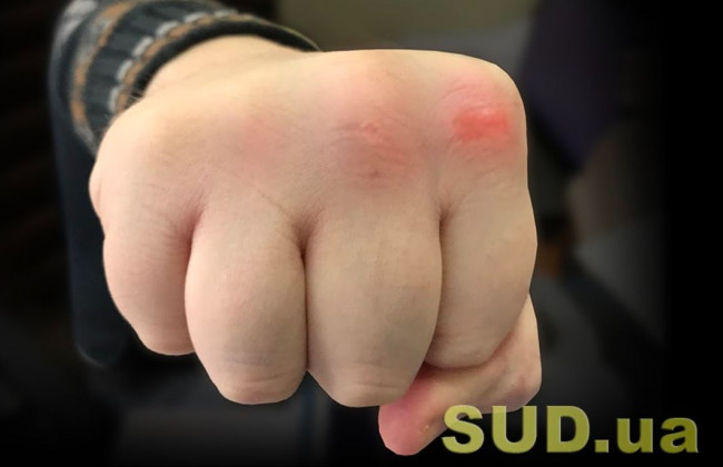 В Киеве мужчина до смерти избил бывшего любимой