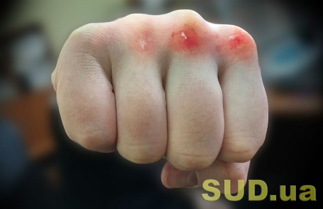 Разбил голову: в Киеве посетитель магазина без маски напал на охранника, видео