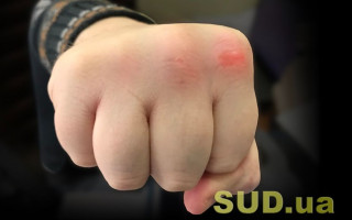 В Киеве мужчина до смерти избил бывшего любимой