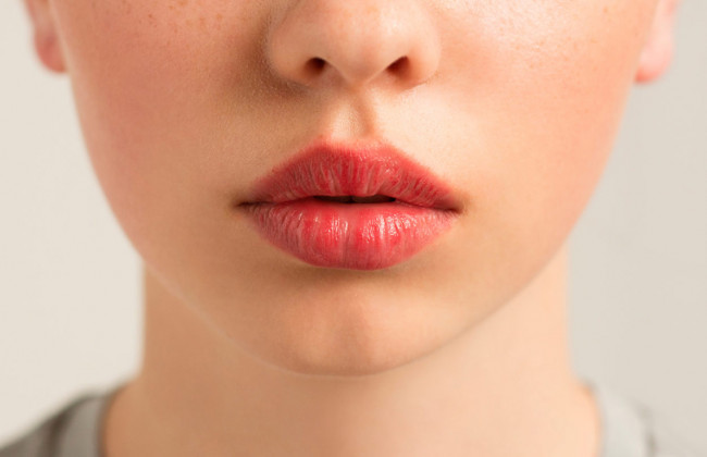 Уколы красоты: в Днепре 14-летняя школьница уколола себе в губы масло и попала на операционный стол