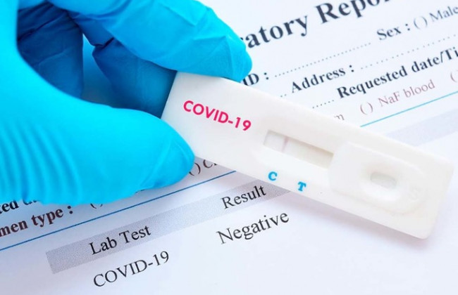 Стало известно, пустят ли в кафе и транспорт  с домашним экспресс-тестом на COVID