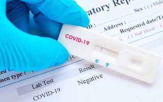 Стало известно, пустят ли в кафе и транспорт  с домашним экспресс-тестом на COVID