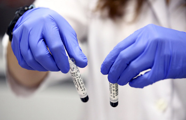 Назвали главное отличие штамма «Омикрон» от «Дельты»