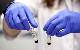 Назвали главное отличие штамма «Омикрон» от «Дельты»