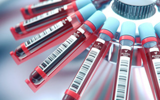 Обнаружили связь между группой крови и заражением коронавирусом