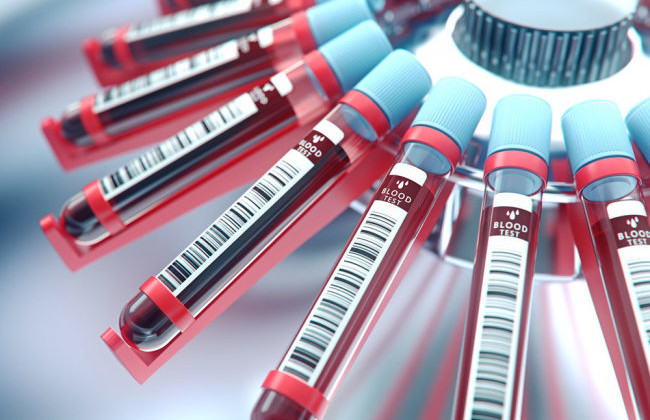 Обнаружили связь между группой крови и заражением коронавирусом
