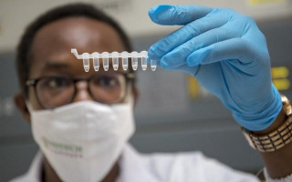 Кожа резко меняет цвет: назвали редкие симптомы штамма «Омикрон»