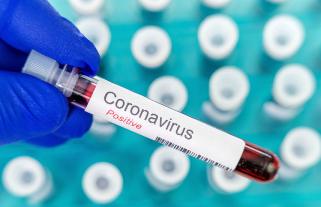 Оставляет антитела, атакующие здоровые ткани: назвали опасное свойство COVID-19