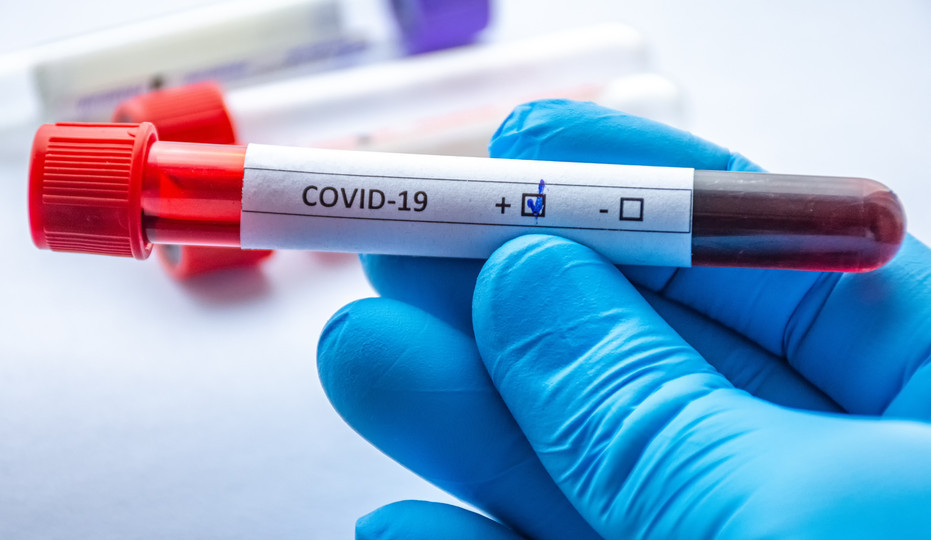 В Украине более 7 тысяч новых случаев COVID-19