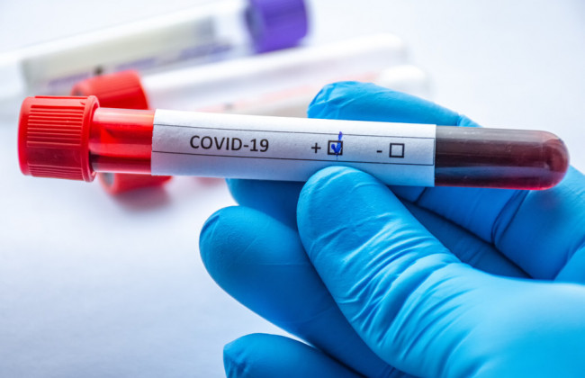 В Украине более 7 тысяч новых случаев COVID-19