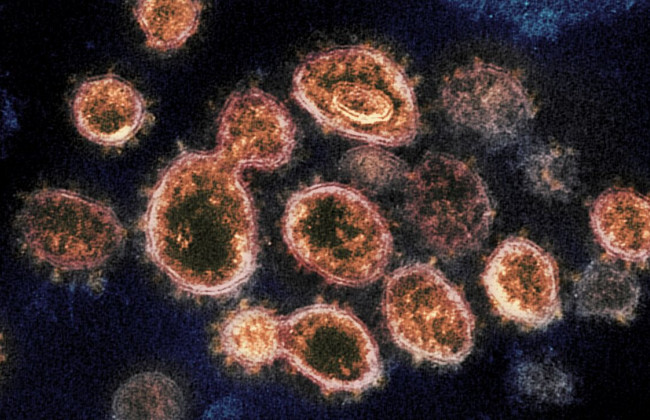 «Дельтакрон»: на Кипре обнаружили гибрид штаммов «Дельта» и «Омикрон»