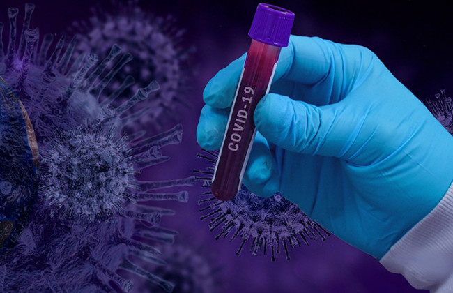 На что обратить внимание: назвали 8 основных симптомов «Омикрона»