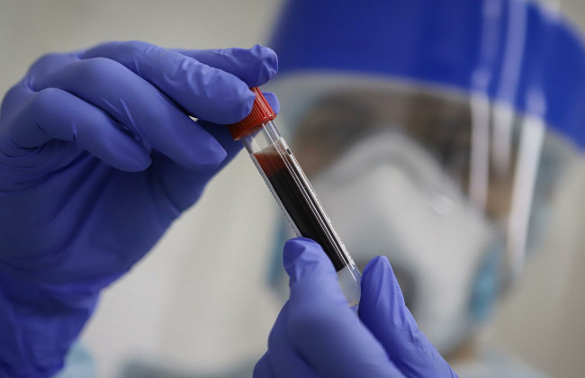 Как иммунитет борется с коронавирусом: выяснили новый факт